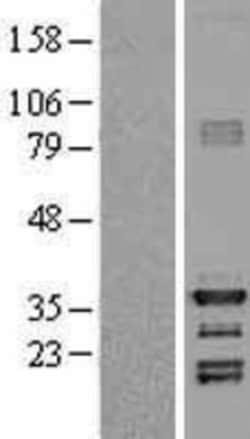 Novus Biologicals&trade;&nbsp;HEY1 Overexpression Lysate
