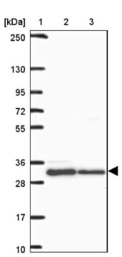 HFE Antibody, Novus Biologicals 0.1mL; Unlabeled:Antibodies, Polyclonal