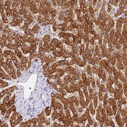 HGD Antibody, Novus Biologicals 0.1mL; Unlabeled:Antibodies, Polyclonal