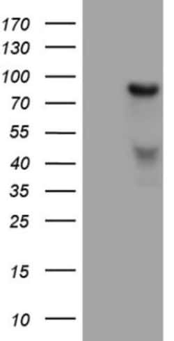 HGF Antibody (OTI1D2), Novus Biologicals 0.1 mL | Buy Online | Novus Biologicals | Fisher Scientific