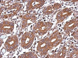 HAI-1/HGFA Inhibitor 1 Antibody, Novus Biologicals 0.1mL; Unlabeled:Antibodies,