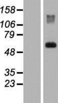 Novus Biologicals&trade;&nbsp;HAI-1/HGFA Inhibitor 1 Overexpression Lysate