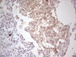 HGFR/c-MET Antibody (OTI1E6), Novus Biologicals 0.1mL; Unlabeled:Antibodies,