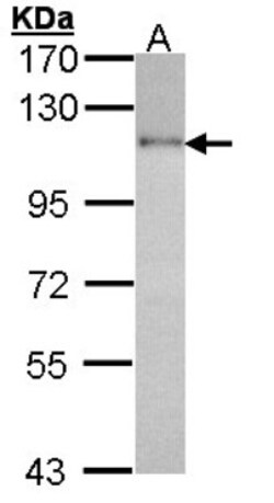 HGS Antibody, Novus Biologicals 0.1mL; Unlabeled:Antibodies, Polyclonal