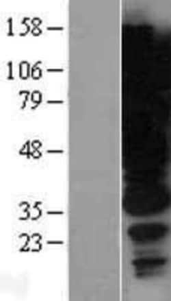 Novus Biologicals&trade;&nbsp;HGS Overexpression Lysate