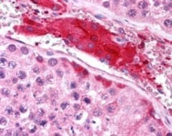 HGS Antibody, Novus Biologicals 0.1mg; Unlabeled:Antibodies, Polyclonal