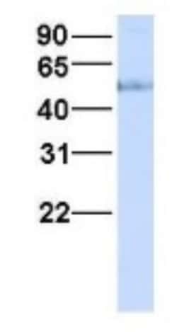 HHAT Antibody, Novus Biologicals 0.05mg; Unlabeled:Antibodies, Polyclonal