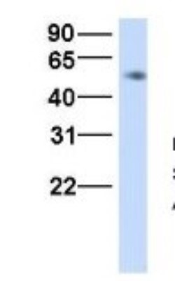 HHAT Antibody, Novus Biologicals 0.05mg; Unlabeled:Antibodies, Polyclonal