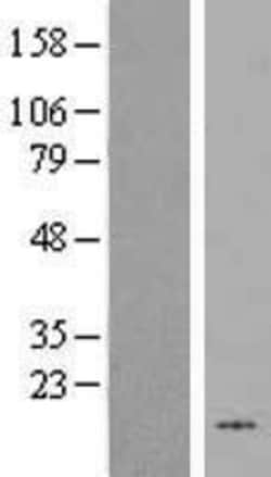 Novus Biologicals&trade;&nbsp;HHLA3 Overexpression Lysate