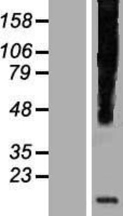 Novus Biologicals&trade;&nbsp;HHLA3 Overexpression Lysate