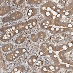 CSN3 Antibody, Novus Biologicals:Antibodies:Primary Antibodies
