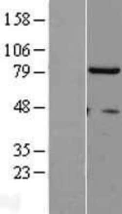Novus Biologicals™ hHpr1-p84-Thoc1 Overexpression Lysate