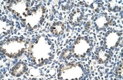 Rad23 Antibody, Novus Biologicals:Antibodies:Primary Antibodies