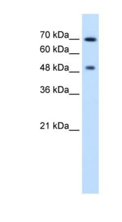 Rad23 Antibody, Novus Biologicals:Antibodies:Primary Antibodies
