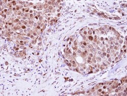 hHR23b Antibody, Novus Biologicals 0.1mL; Unlabeled:Antibodies, Polyclonal