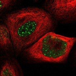 hHR23b Antibody, Novus Biologicals 0.1mL; Unlabeled:Antibodies, Polyclonal