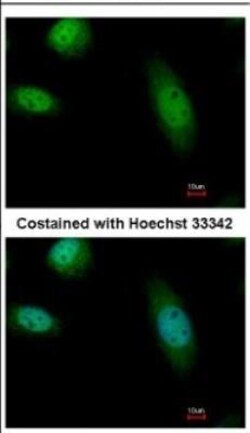 hHR23b Antibody, Novus Biologicals 0.1mL; Unlabeled:Antibodies, Polyclonal