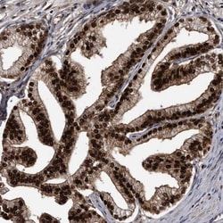 hHR23b Antibody, Novus Biologicals 0.1mL; Unlabeled:Antibodies, Polyclonal
