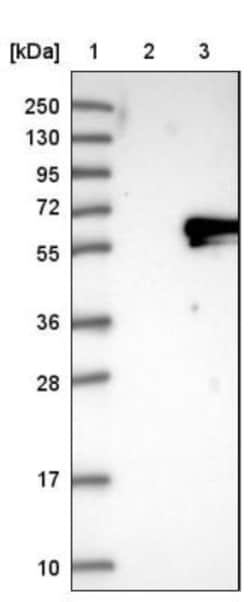 hHR23b Antibody, Novus Biologicals 0.1mL; Unlabeled:Antibodies, Polyclonal