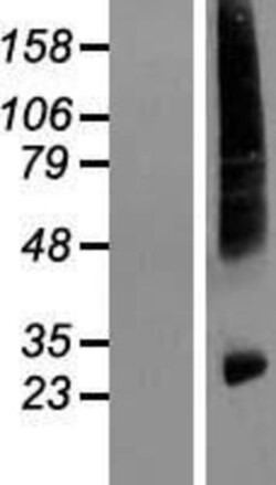 Novus Biologicals&trade;&nbsp;HIATL1 Overexpression Lysate