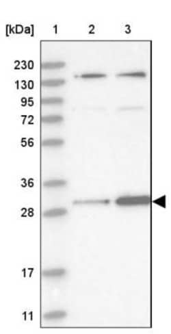 HIBADH Antibody, Novus Biologicals 0.1 mL | Buy Online | Novus Biologicals | Fisher Scientific
