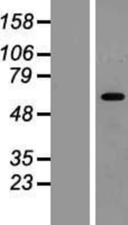 Novus Biologicals&trade;&nbsp;HIC2 Overexpression Lysate