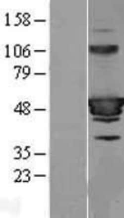 Novus Biologicals™ HIC5/TGFB1I1 Overexpression Lysate