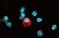 Novus Biologicals HIF-1 alpha Antibody Pack 5 vials:Antibodies