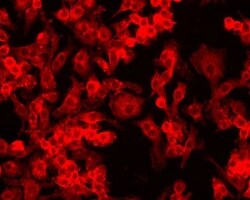 Novus Biologicals HIF-1 alpha Antibody Pack 5 vials:Antibodies