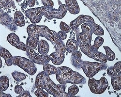 Novus Biologicals HIF-1 alpha Antibody Packs 4 vials:Antibodies