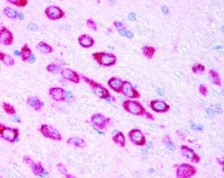 Novus Biologicals HIF-1 alpha Antibody Packs 4 vials:Antibodies