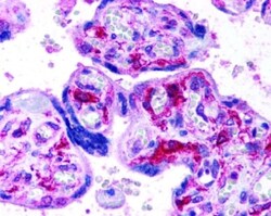 Novus Biologicals HIF-1 alpha Antibody Packs 4 vials:Antibodies