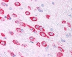 Novus Biologicals HIF-1 alpha Antibody Pack 5 vials:Antibodies