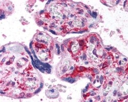 Novus Biologicals HIF-1 alpha Antibody Pack 5 vials:Antibodies