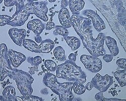 Novus Biologicals HIF-1 alpha Antibody Packs 4 vials:Antibodies
