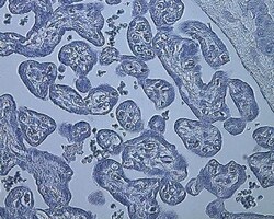 Novus Biologicals HIF-1 alpha Antibody Pack 5 vials:Antibodies