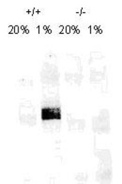 Novus Biologicals HIF-1 alpha Antibody Packs 4 vials:Antibodies