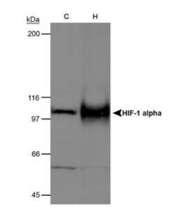 Novus Biologicals HIF-1 alpha Antibody Pack 5 vials:Antibodies