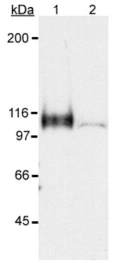 Novus Biologicals HIF-1 alpha Antibody Pack 5 vials:Antibodies