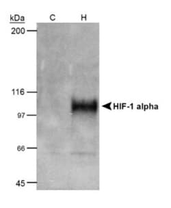 Novus Biologicals HIF-1 alpha Antibody Pack 5 vials:Antibodies