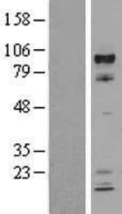 Novus Biologicals™ ARNT/HIF-1 beta Overexpression Lysate
