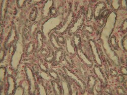 HIF-1 alpha Antibody (ESEE122), Novus Biologicals 0.1mL; Unlabeled:Antibodies,