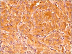 HIF-1 alpha Antibody (ESEE122), Novus Biologicals 0.1mL; Unlabeled:Antibodies,