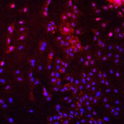 HIF-1 alpha Antibody (H1alpha67), Novus Biologicals:Antibodies:Primary