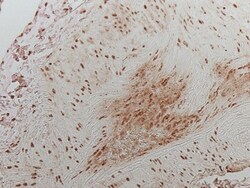 HIF-1 alpha Antibody (H1alpha67), Novus Biologicals:Antibodies:Primary