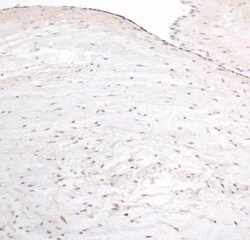 HIF-1 alpha Antibody (H1alpha67), Novus Biologicals:Antibodies:Primary