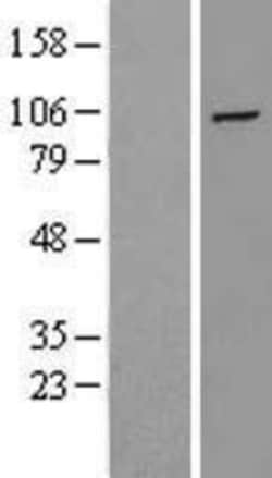 Novus Biologicals&trade;&nbsp;HIF-2 alpha/EPAS1 Overexpression Lysate
