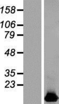 Novus Biologicals&trade;&nbsp;HIGD1B Overexpression Lysate