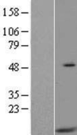 Novus Biologicals&trade;&nbsp;HIGD2A Overexpression Lysate