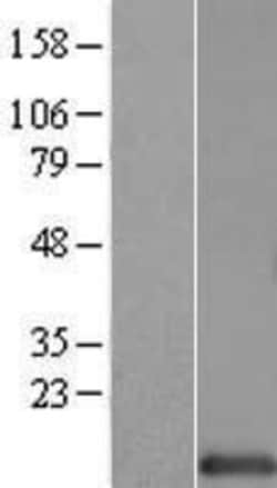 Novus Biologicals&trade;&nbsp;HINT1 Overexpression Lysate